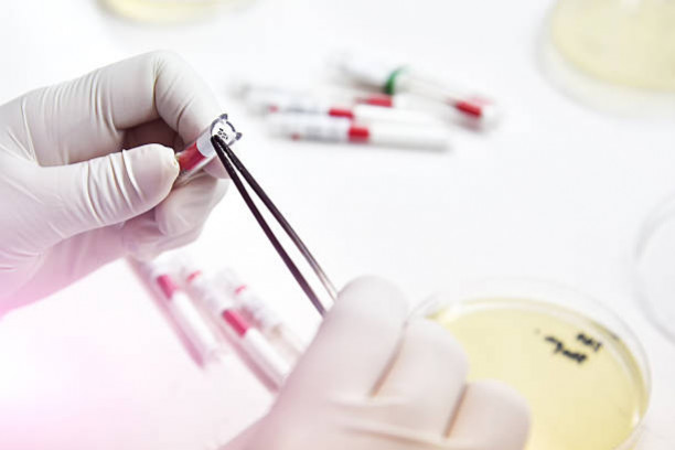 Prendre soin de votre compagnon à quatre pattes : L'importance du bilan sanguin